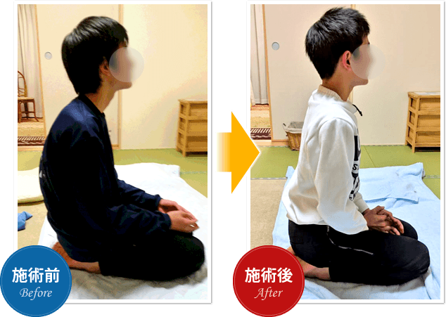 Before After