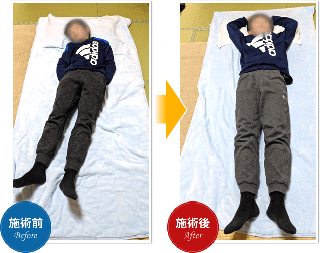 Before After