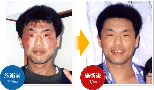 Before After